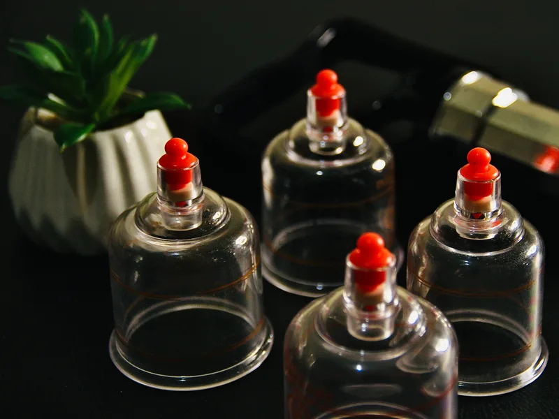 How Cupping Therapy works at Towson Integrative Health