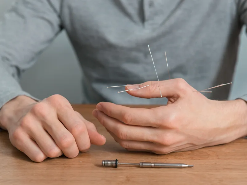 Dry Needling at Towson Integrative Health in Towson