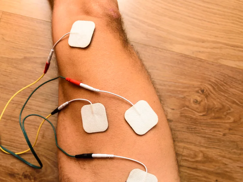 Electrotherapy at Towson Integrative Health in Towson