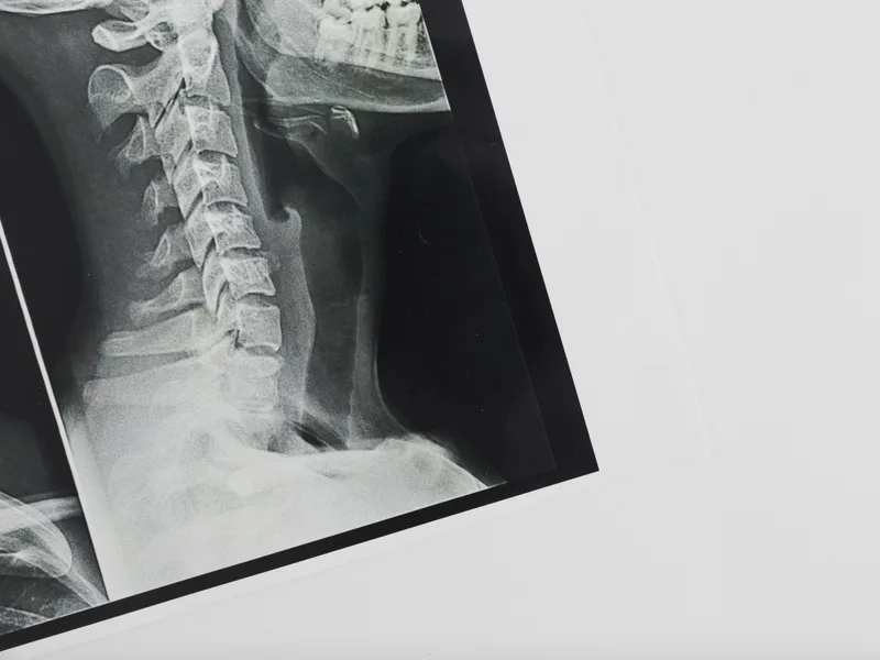 X-Rays at Towson Integrative Health in Towson