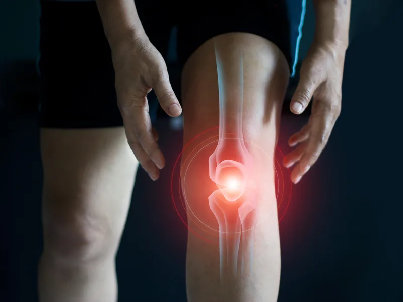 How Towson Integrative Health treats arthritis in Towson
